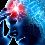 Ibimenyetso bikuburira byagufasha kwirinda stroke, indwara yica benshi cyane cyane abirabura stroke