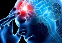 stroke