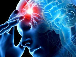 Ibimenyetso bikuburira byagufasha kwirinda stroke, indwara yica benshi cyane cyane abirabura stroke