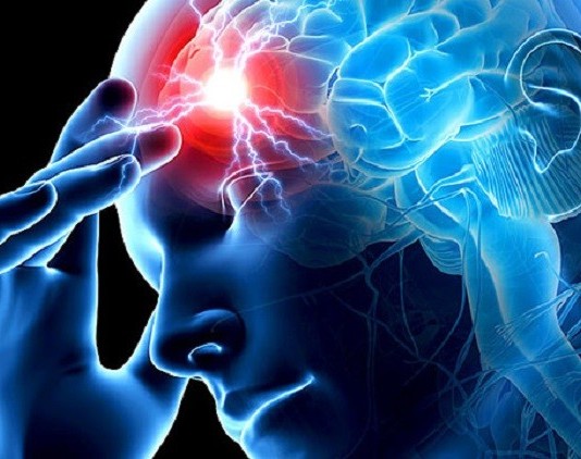 Ibimenyetso bikuburira byagufasha kwirinda stroke, indwara yica benshi cyane cyane abirabura stroke