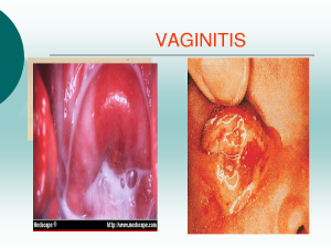 Vaginitis ishobora gutera kuva amaraso mu gihe ukora imiibonano mpuzabitsina 