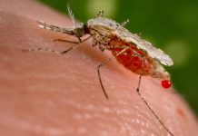 Malaria