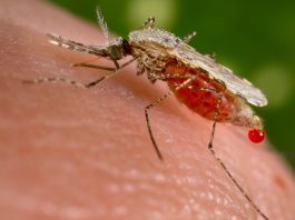 Indwara ya malaria: ikiyitera, ibimenyetso, uko isuzumwa n’uko ivurwa Malaria