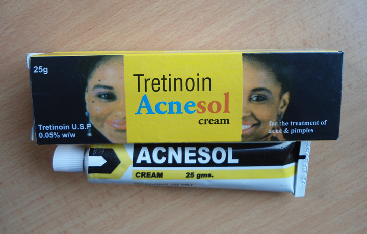 Ibiheri byo mu maso ni indwara ishobora kuvurwa igakira iyo wivuje neza