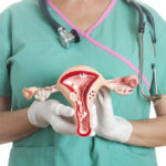 Kanseri y’inkondo y’umura (cervical cancer) Kanseri y’inkondo y’umura